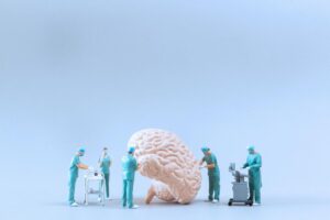 Memory Loss Treatment in Patna